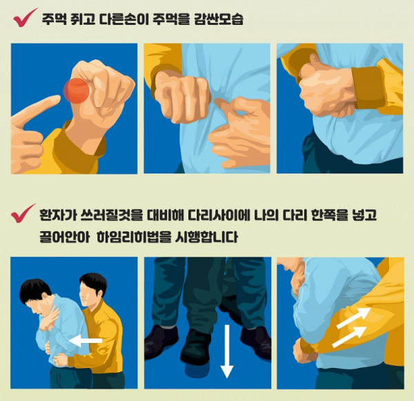 하임리히법.png